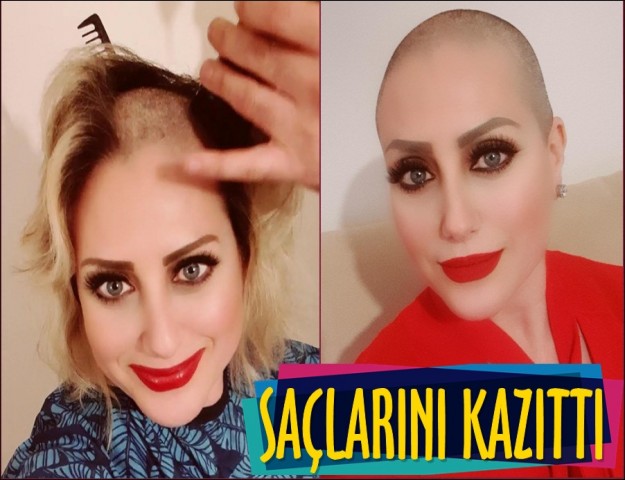 SAÇLARINI KAZITTI!