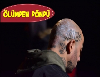 ÇEKİMİNDE BEKLENMEYEN KAZA