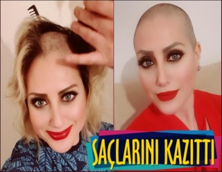 SAÇLARINI KAZITTI!